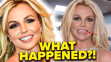 britney spears teeth|What Happened to Britney Spears: From Iconic Teeth。